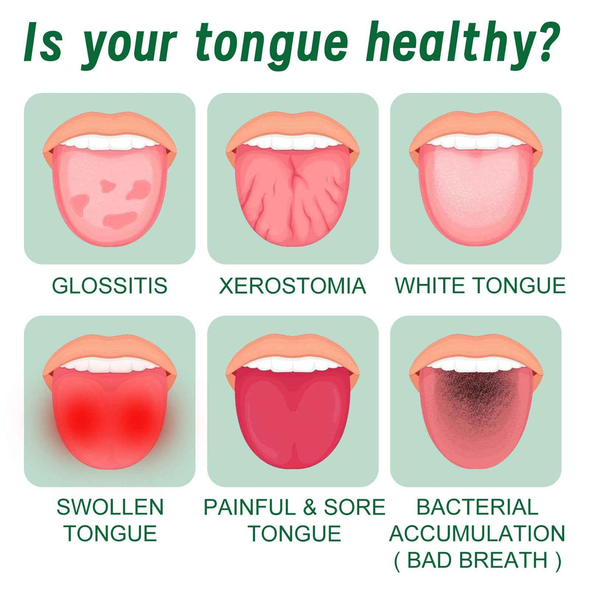 EELHOE Tongue Repair Spray Repair white tongue coating, relieve dry cracked and swollen tongue, oral care spray