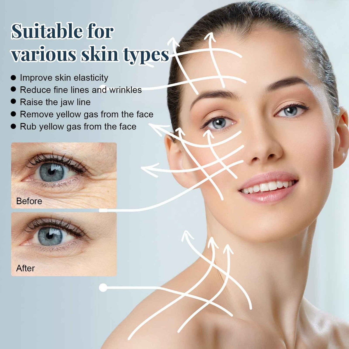 Protein Lifting Threads – Anti-Wrinkle V-Shape Facial Contour Enhancement