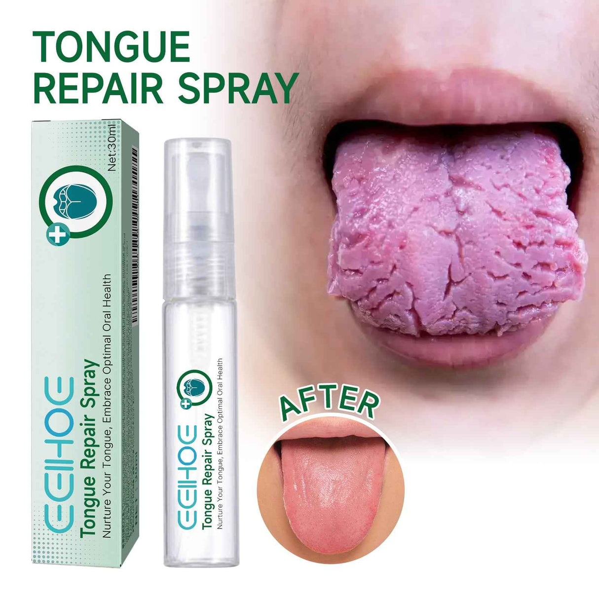 EELHOE Tongue Repair Spray Repair white tongue coating, relieve dry cracked and swollen tongue, oral care spray