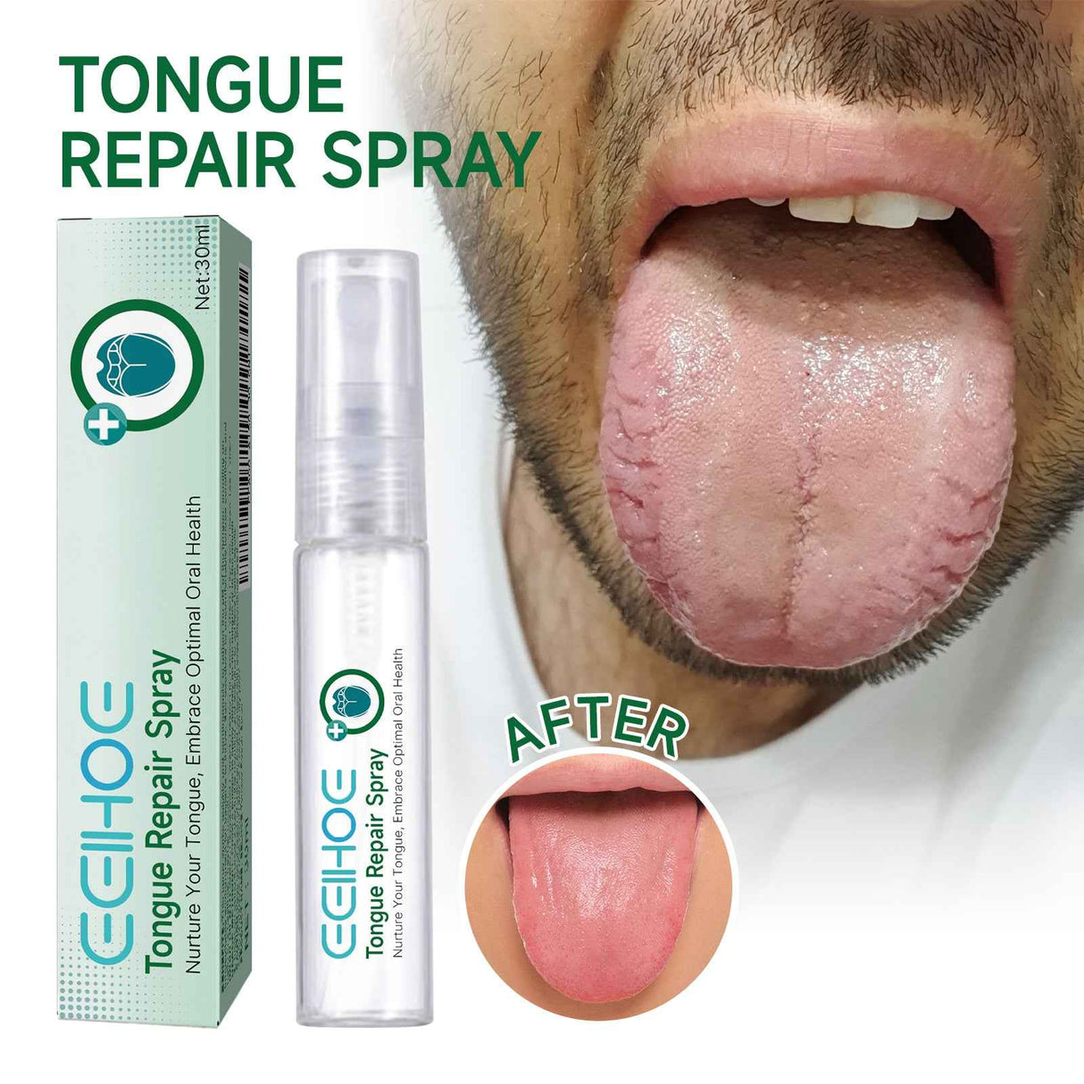 EELHOE Tongue Repair Spray Repair white tongue coating, relieve dry cracked and swollen tongue, oral care spray