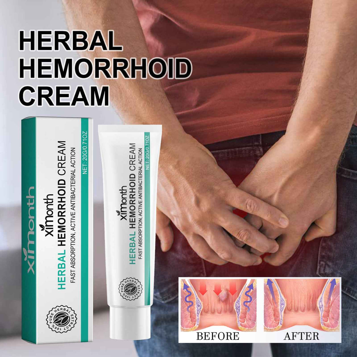 Ximonth Hemorrhoids ointment Relieve Perianal Itching Pain Discomfort Eliminate Hemorrhoids Eliminate Meat Ball Body Care Hemorrhoids Cream
