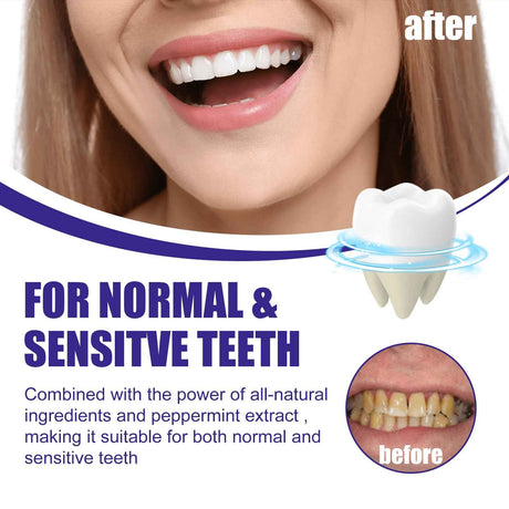 EELHOE Tooth cleaning powder Removes tartar, whitens teeth, cleans and removes bad breath, freshens breath