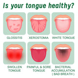 EELHOE Tongue Repair Spray Repair white tongue coating, relieve dry cracked and swollen tongue, oral care spray