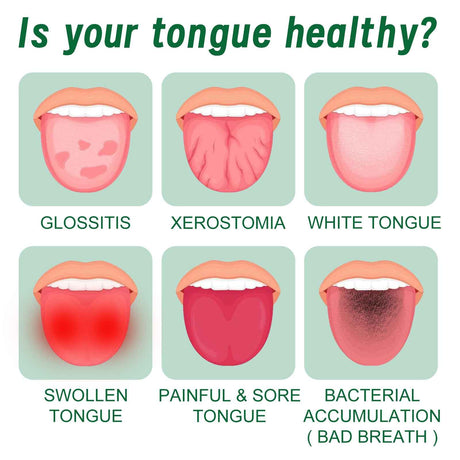 EELHOE Tongue Repair Spray Repair white tongue coating, relieve dry cracked and swollen tongue, oral care spray