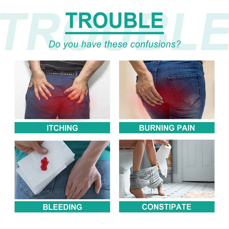 Ximonth Hemorrhoids ointment Relieve Perianal Itching Pain Discomfort Eliminate Hemorrhoids Eliminate Meat Ball Body Care Hemorrhoids Cream