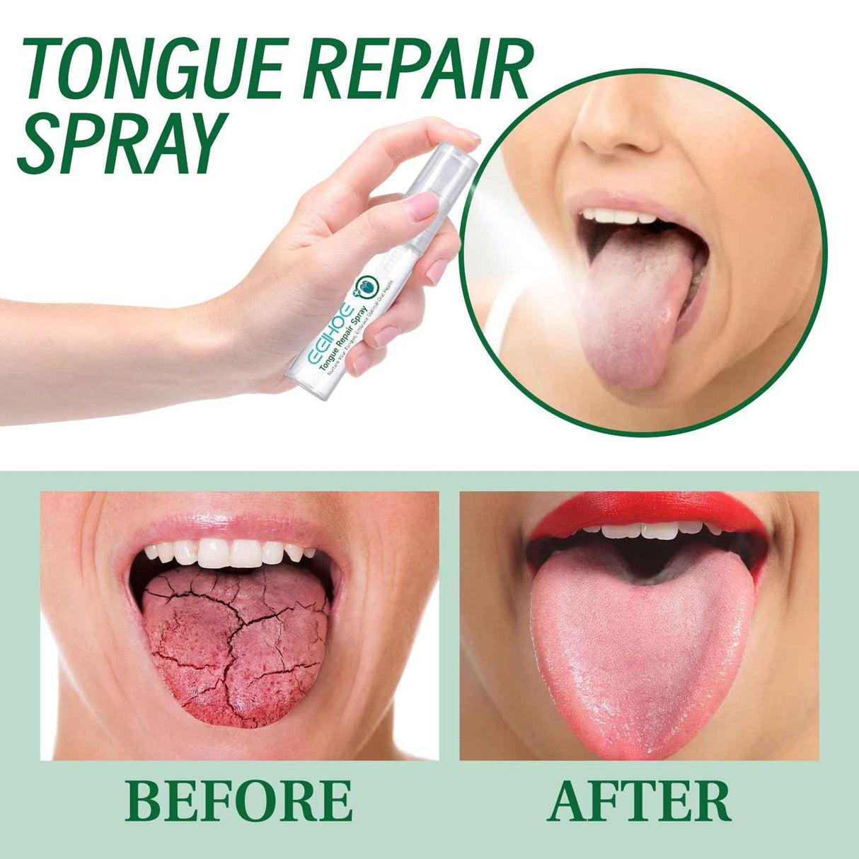 EELHOE Tongue Repair Spray Repair white tongue coating, relieve dry cracked and swollen tongue, oral care spray