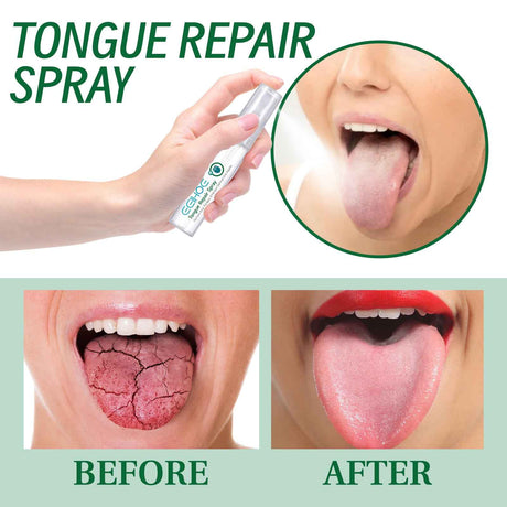EELHOE Tongue Repair Spray Repair white tongue coating, relieve dry cracked and swollen tongue, oral care spray