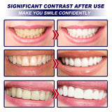 EELHOE Whitening tooth strips Dental care stain remover, whitening and cleaning strips