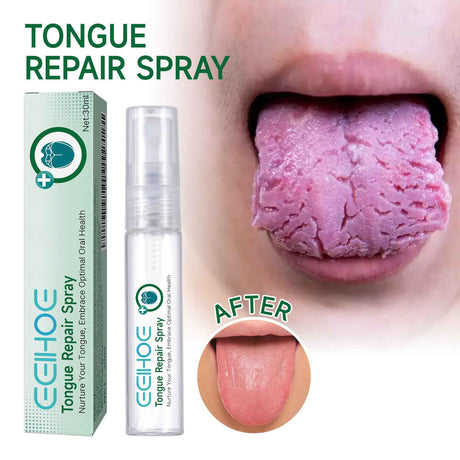 EELHOE Tongue Repair Spray Repair white tongue coating, relieve dry cracked and swollen tongue, oral care spray