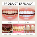 Oralhoe Brightening Toothpaste Brightening Teeth Gentle Cleaning Toothpaste for Stains and Fresh Breath Oral Care