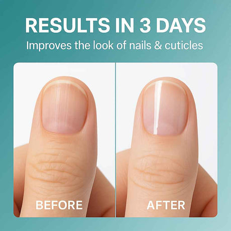 3-Day Nail Care Oil - Lightweight Fast-Absorbing Water-Like Serum Texture for Continuous Nail Health Maintenance