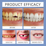 Oralhoe Teeth Care Kit Enhance Smile Aesthetics Gentle Comfortable Teeth Care for Bright and Shiny Teeth