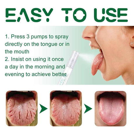 EELHOE Tongue Repair Spray Repair white tongue coating, relieve dry cracked and swollen tongue, oral care spray