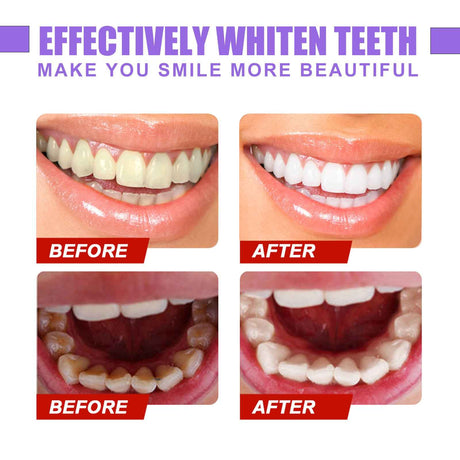 EELHOE V34Teeth Whitening Toothpaste Oral Whitening Cleaning Tooth Stain Whitening Teeth Purple Toothpaste