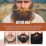 East Moon Beard Growth Serum for Men Natural Nourishing & Strengthening Facial Hair Care Liquid Beard Thickening Treatment