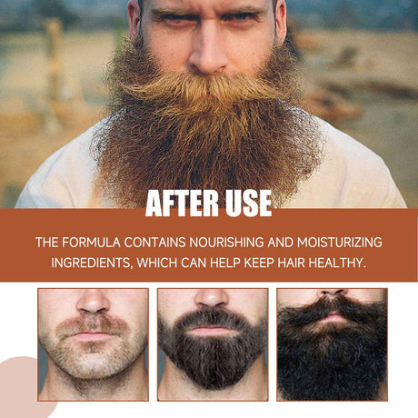 East Moon Beard Growth Serum for Men Natural Nourishing & Strengthening Facial Hair Care Liquid Beard Thickening Treatment